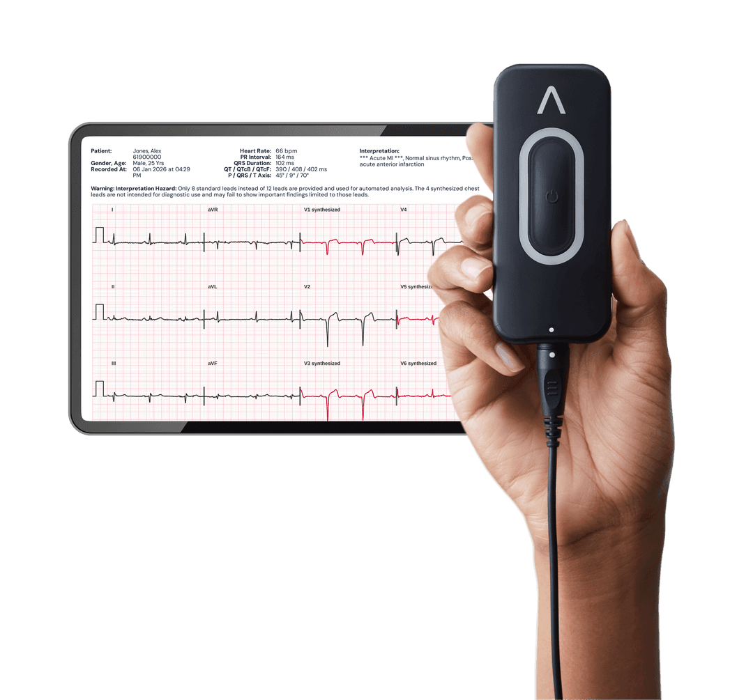 Kardia 12L EKG